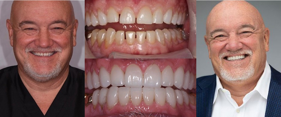 See the difference NYC smile design has made for Dr. Eric Farmer