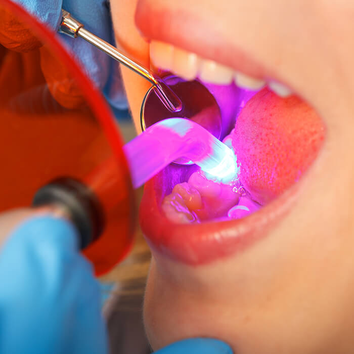  An open mouth with a dental instrument working