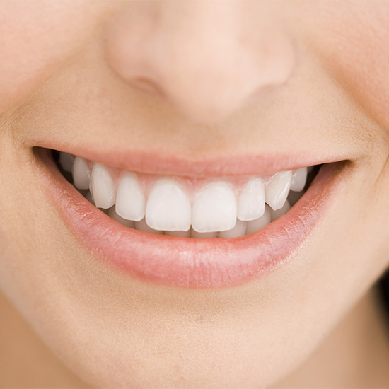  A smile showing upper teeth