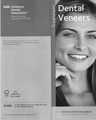 John Nosti Media File Dental Veneers Cover